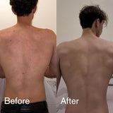 Shield Men's Acne Body Wash for Back, Chest & Shoulders - 4% Benzoyl Peroxide Body Wash, Clears Breakouts & Acne Scars – Unscented with Niacinamide, Glycolic Acid & Ceramides, 8.5 oz