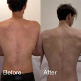 Shield Men's Acne Body Wash for Back, Chest & Shoulders - 4% Benzoyl Peroxide Body Wash, Clears Breakouts & Acne Scars – Unscented with Niacinamide, Glycolic Acid & Ceramides, 8.5 oz